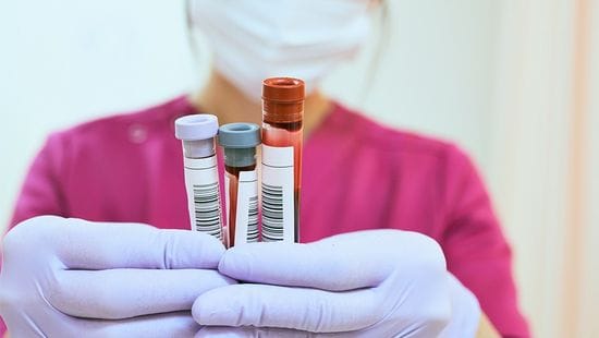 An Accurate Blood Test to Predict More Than 50 Cancers